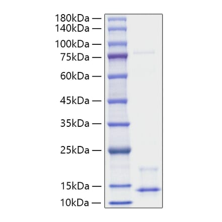 SDS-PAGE - Recombinant Human NRG1 Protein (A331119) - Antibodies.com