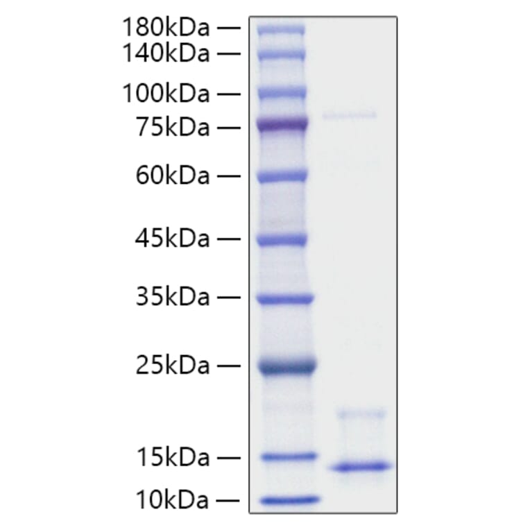 SDS-PAGE - Recombinant Human NRG1 Protein (A331119) - Antibodies.com
