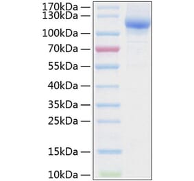 SDS-PAGE - Recombinant Human NRP2 Protein (C-terminal His Tag) (A331120) - Antibodies.com