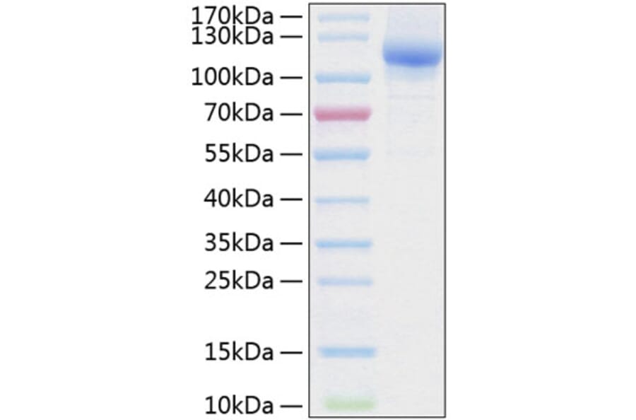 SDS-PAGE - Recombinant Human NRP2 Protein (C-terminal His Tag) (A331120) - Antibodies.com
