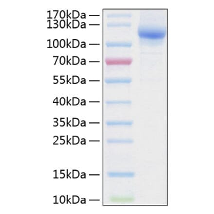 SDS-PAGE - Recombinant Human NRP2 Protein (C-terminal His Tag) (A331120) - Antibodies.com