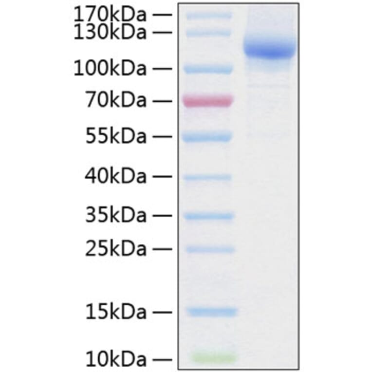 SDS-PAGE - Recombinant Human NRP2 Protein (C-terminal His Tag) (A331120) - Antibodies.com