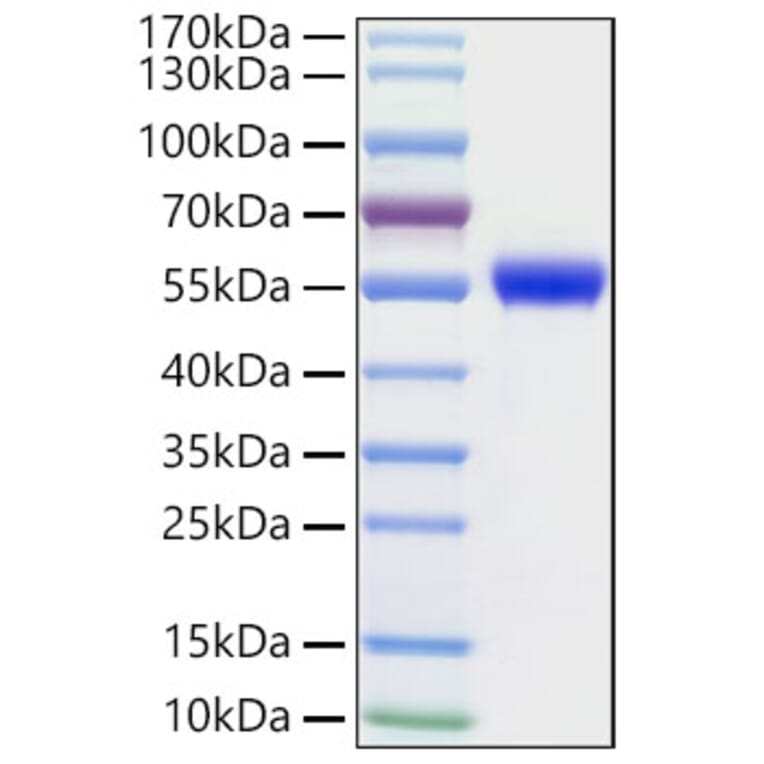 SDS-PAGE - Recombinant Human NSE Protein (N-terminal His Tag) (A331121) - Antibodies.com