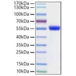 SDS-PAGE - Recombinant Human NSE Protein (N-terminal His Tag) (A331121) - Antibodies.com