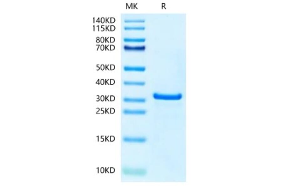 SDS-PAGE - Recombinant Human NUDT5 Protein (N-terminal His Tag) (A331123) - Antibodies.com