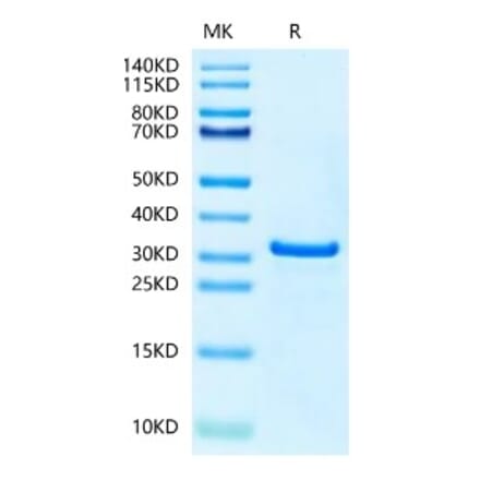 SDS-PAGE - Recombinant Human NUDT5 Protein (N-terminal His Tag) (A331123) - Antibodies.com