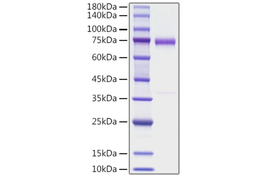 SDS-PAGE - Recombinant human OLFM4 Protein (C-terminal His Tag) (A331124) - Antibodies.com