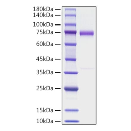 SDS-PAGE - Recombinant human OLFM4 Protein (C-terminal His Tag) (A331124) - Antibodies.com
