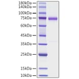 SDS-PAGE - Recombinant human OLFM4 Protein (C-terminal His Tag) (A331124) - Antibodies.com