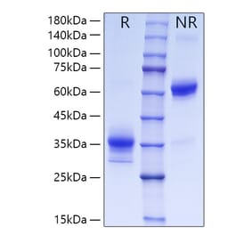 SDS-PAGE - Recombinant Human OLR1 Protein (C-terminal His Tag) (A331125) - Antibodies.com