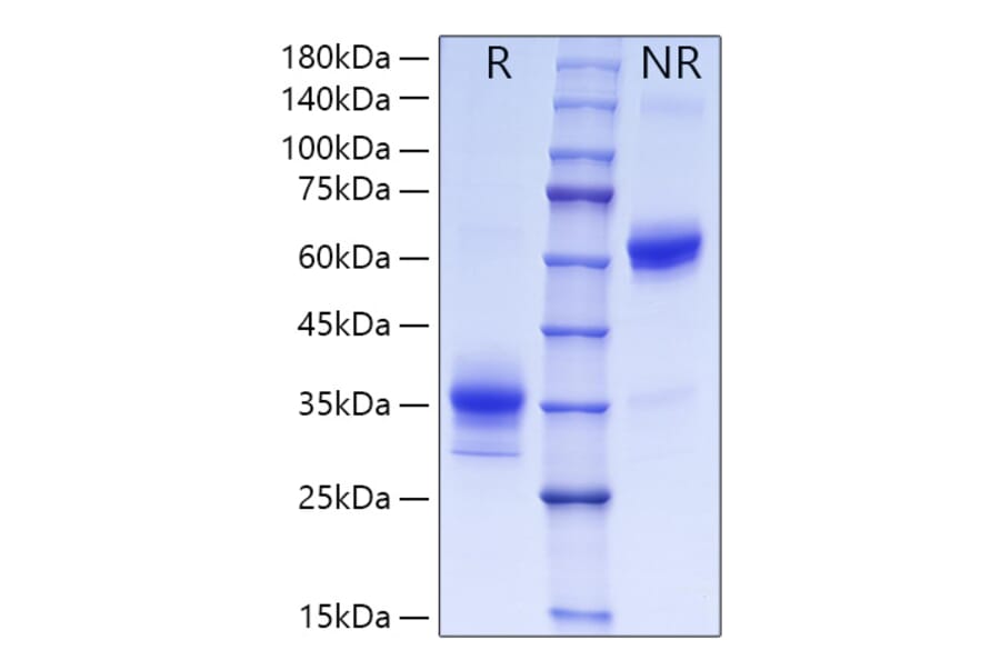 SDS-PAGE - Recombinant Human OLR1 Protein (C-terminal His Tag) (A331125) - Antibodies.com