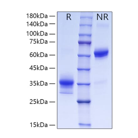 SDS-PAGE - Recombinant Human OLR1 Protein (C-terminal His Tag) (A331125) - Antibodies.com