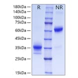 SDS-PAGE - Recombinant Human OLR1 Protein (C-terminal His Tag) (A331125) - Antibodies.com