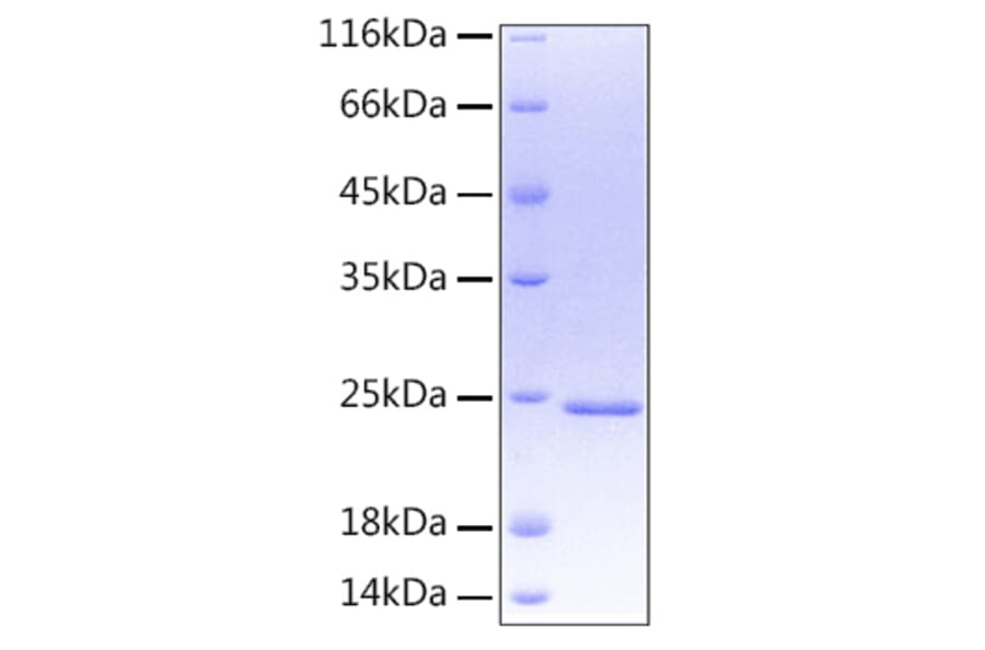 SDS-PAGE - Recombinant Human Oncostatin M/OSM Protein (A331126) - Antibodies.com