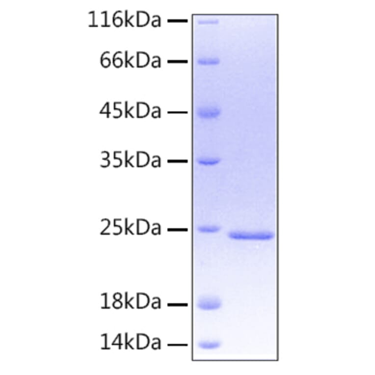 SDS-PAGE - Recombinant Human Oncostatin M/OSM Protein (A331126) - Antibodies.com