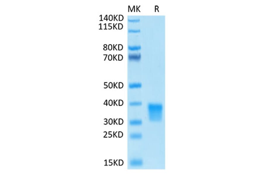 Tris-Bis PAGE - Recombinant Human Oncostatin M/OSM Protein (Biotin) (C-terminal His and Avi Tag) (A331127) - Antibodies.com