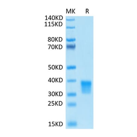 Tris-Bis PAGE - Recombinant Human Oncostatin M/OSM Protein (Biotin) (C-terminal His and Avi Tag) (A331127) - Antibodies.com