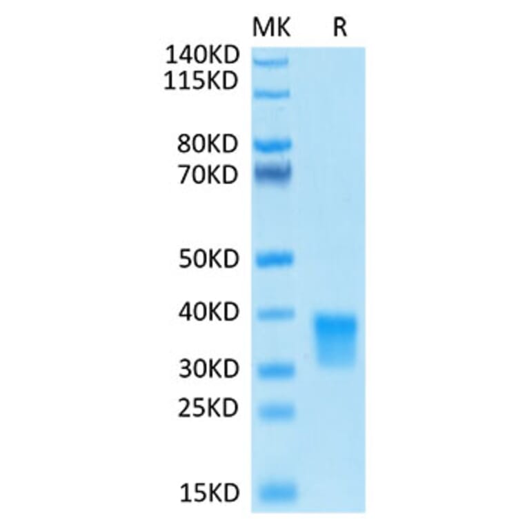 Tris-Bis PAGE - Recombinant Human Oncostatin M/OSM Protein (Biotin) (C-terminal His and Avi Tag) (A331127) - Antibodies.com