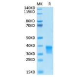 Tris-Bis PAGE - Recombinant Human Oncostatin M/OSM Protein (Biotin) (C-terminal His and Avi Tag) (A331127) - Antibodies.com