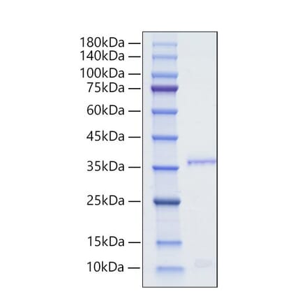 SDS-PAGE - Recombinant Human Orexin Protein (N-terminal Human Fc Tag) (A331128) - Antibodies.com