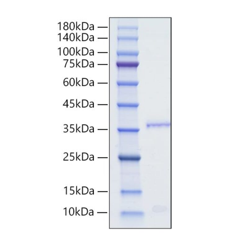 SDS-PAGE - Recombinant Human Orexin Protein (N-terminal Human Fc Tag) (A331128) - Antibodies.com