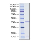 SDS-PAGE - Recombinant Human Orexin Protein (N-terminal Human Fc Tag) (A331128) - Antibodies.com