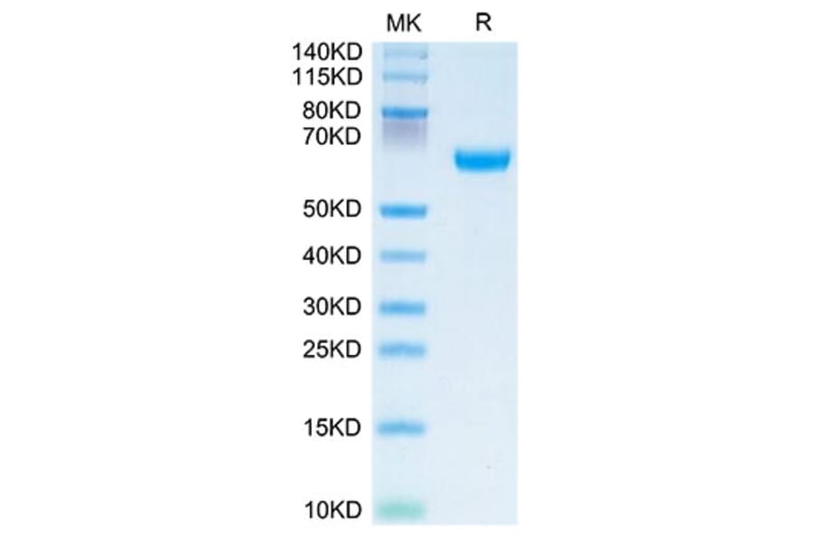 Tris-Bis PAGE - Recombinant Human OSCAR Protein (C-terminal Human Fc Tag) (A331129) - Antibodies.com