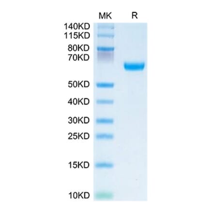 Tris-Bis PAGE - Recombinant Human OSCAR Protein (C-terminal Human Fc Tag) (A331129) - Antibodies.com