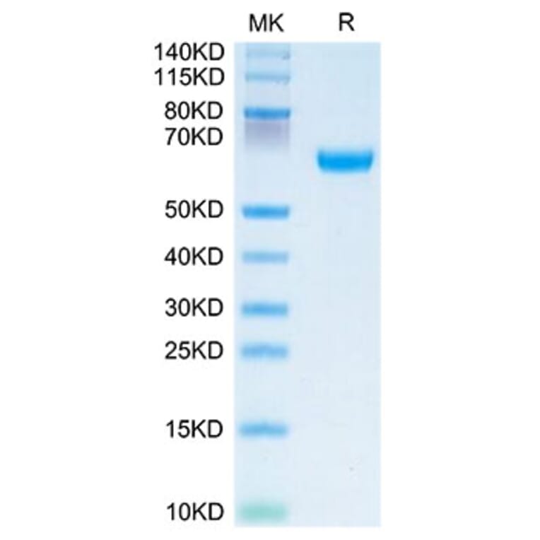 Tris-Bis PAGE - Recombinant Human OSCAR Protein (C-terminal Human Fc Tag) (A331129) - Antibodies.com