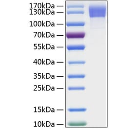 SDS-PAGE - Recombinant Human OSMR Protein (C-terminal His Tag) (A331130) - Antibodies.com