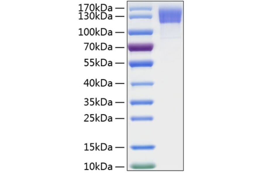SDS-PAGE - Recombinant Human OSMR Protein (C-terminal His Tag) (A331130) - Antibodies.com