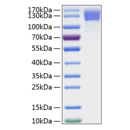 SDS-PAGE - Recombinant Human OSMR Protein (C-terminal His Tag) (A331130) - Antibodies.com