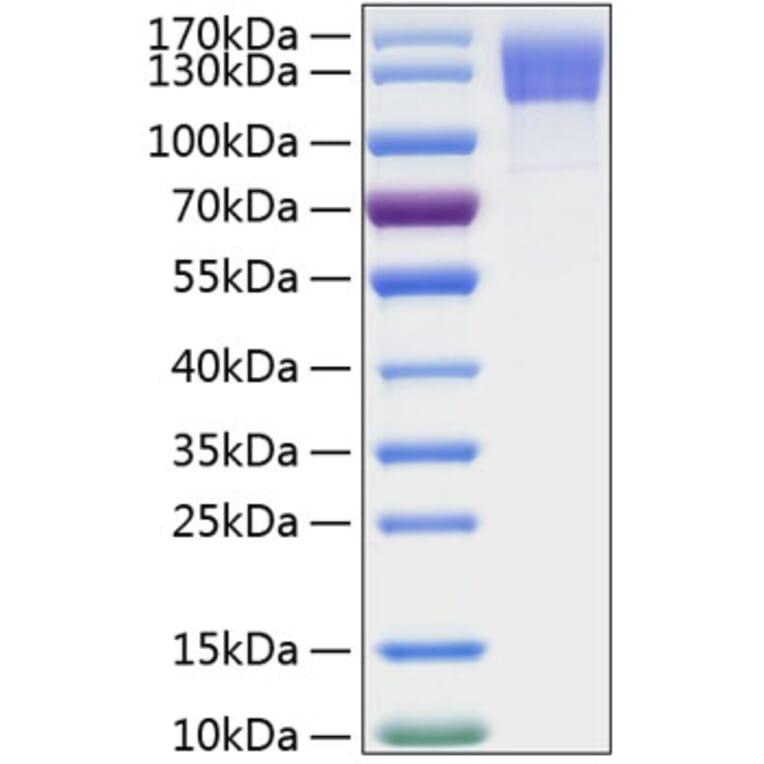 SDS-PAGE - Recombinant Human OSMR Protein (C-terminal His Tag) (A331130) - Antibodies.com