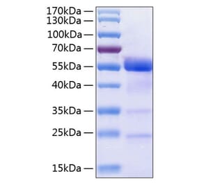 SDS-PAGE - Recombinant Human Osteopontin Protein (C-terminal His Tag) (A331131) - Antibodies.com