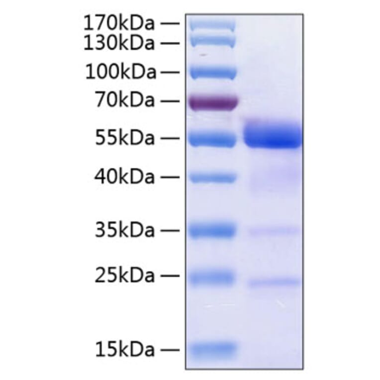 SDS-PAGE - Recombinant Human Osteopontin Protein (C-terminal His Tag) (A331131) - Antibodies.com