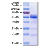 SDS-PAGE - Recombinant Human Osteopontin Protein (C-terminal His Tag) (A331131) - Antibodies.com