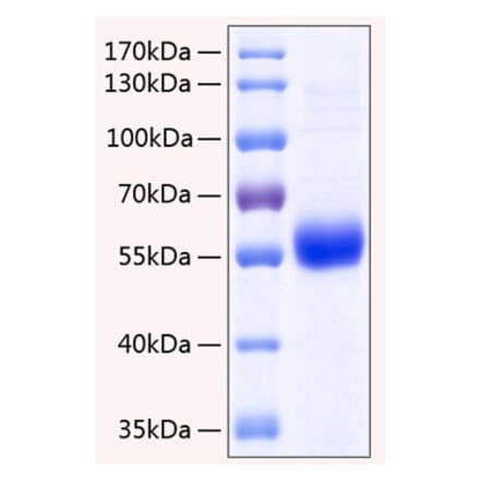 SDS-PAGE - Recombinant Human Osteoprotegerin Protein (C-terminal His Tag) (A331132) - Antibodies.com