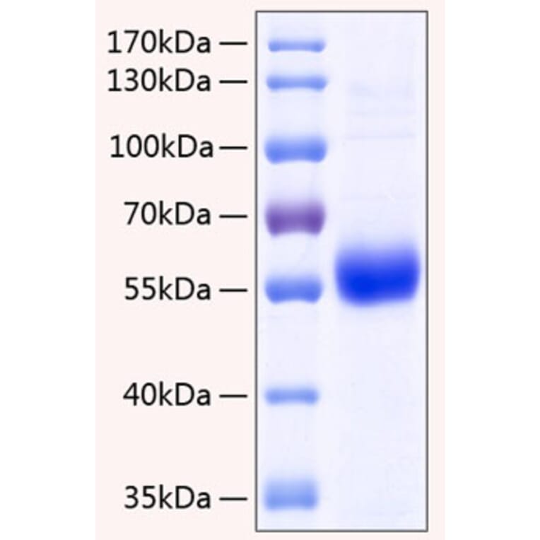 SDS-PAGE - Recombinant Human Osteoprotegerin Protein (C-terminal His Tag) (A331132) - Antibodies.com