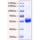 SDS-PAGE - Recombinant Human Osteoprotegerin Protein (C-terminal His Tag) (A331132) - Antibodies.com