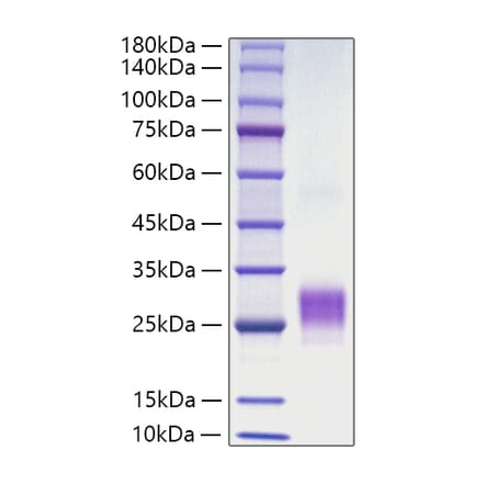SDS-PAGE - Recombinant Human OX40L Protein (N-terminal His Tag) (A331133) - Antibodies.com