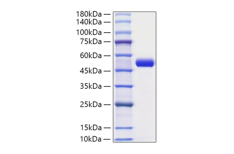 SDS-PAGE - Recombinant Human PAI1 Protein (C-terminal His Tag) (A331134) - Antibodies.com