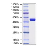 SDS-PAGE - Recombinant Human PAI1 Protein (C-terminal His Tag) (A331134) - Antibodies.com