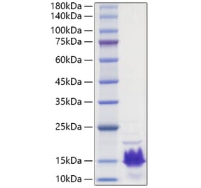 SDS-PAGE - Recombinant Human Parathyroid Hormone Protein (A331135) - Antibodies.com