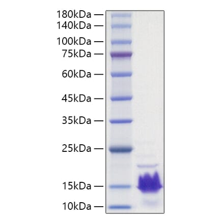 SDS-PAGE - Recombinant Human Parathyroid Hormone Protein (A331135) - Antibodies.com