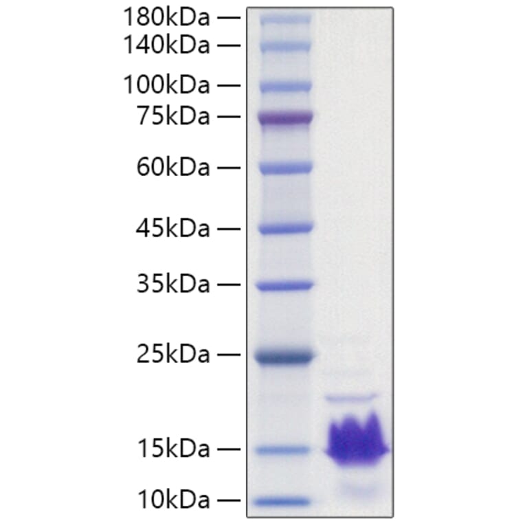 SDS-PAGE - Recombinant Human Parathyroid Hormone Protein (A331135) - Antibodies.com