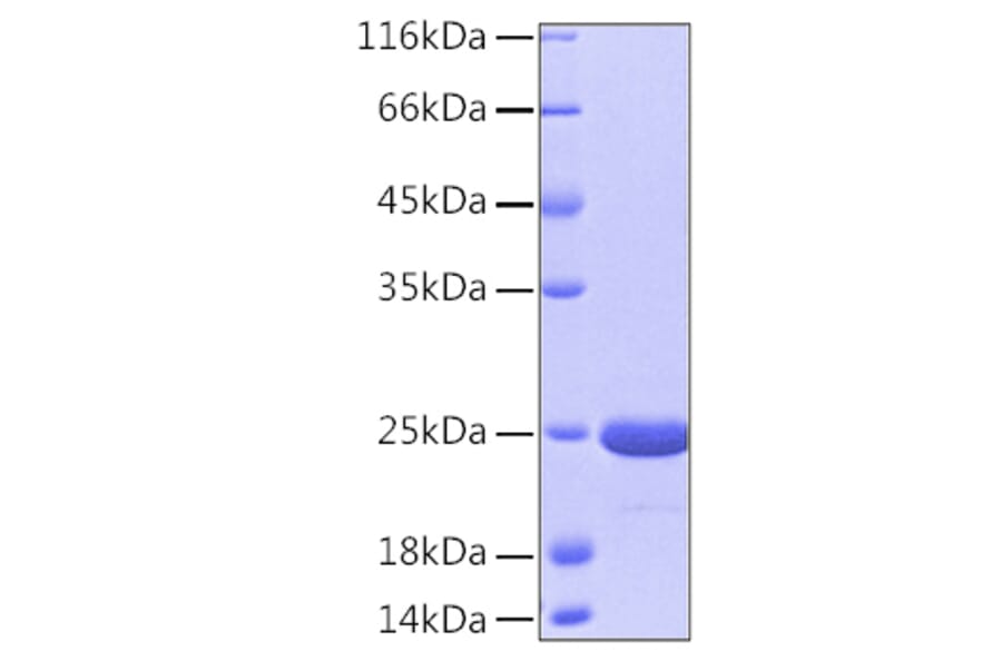 SDS-PAGE - Recombinant Human PARK7/DJ1 Protein (A331136) - Antibodies.com