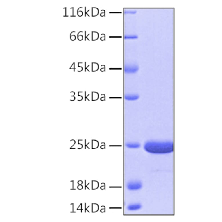 SDS-PAGE - Recombinant Human PARK7/DJ1 Protein (A331136) - Antibodies.com