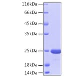 SDS-PAGE - Recombinant Human PARK7/DJ1 Protein (A331136) - Antibodies.com