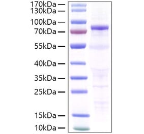 SDS-PAGE - Recombinant Human P-Cadherin Protein (C-terminal His Tag) (A331137) - Antibodies.com