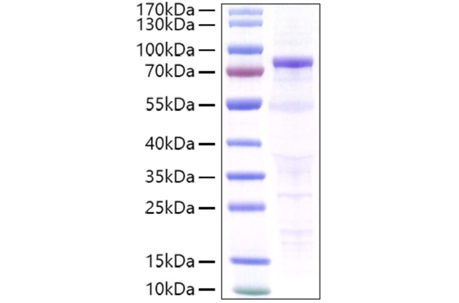 SDS-PAGE - Recombinant Human P-Cadherin Protein (C-terminal His Tag) (A331137) - Antibodies.com